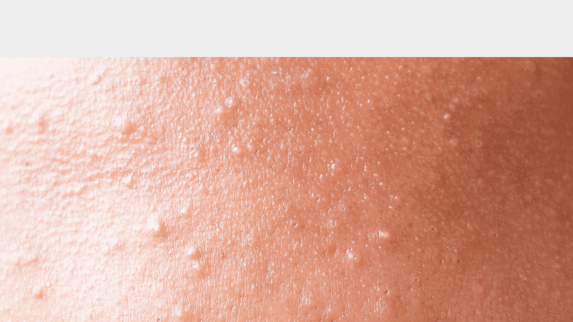 What Causes Clogged Pores and How to Treat Them (Without Overcomplicating Your Routine) - GRAES
